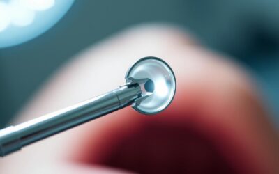 Izvrtanje larinksalnih vrećica kod pasa – Sve što trebate znati o tome!