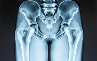 Blog 24 Rendgen zglobova pasa – Sve što trebaš znati o tome!